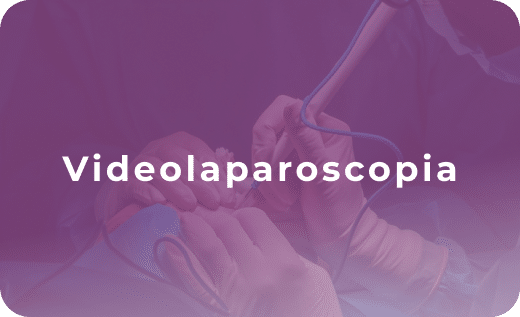 Videolaparoscopia