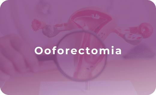 Ooforectomia